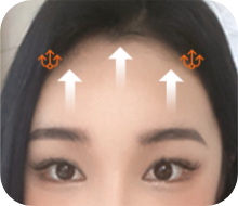 순서 4 : 실 고정