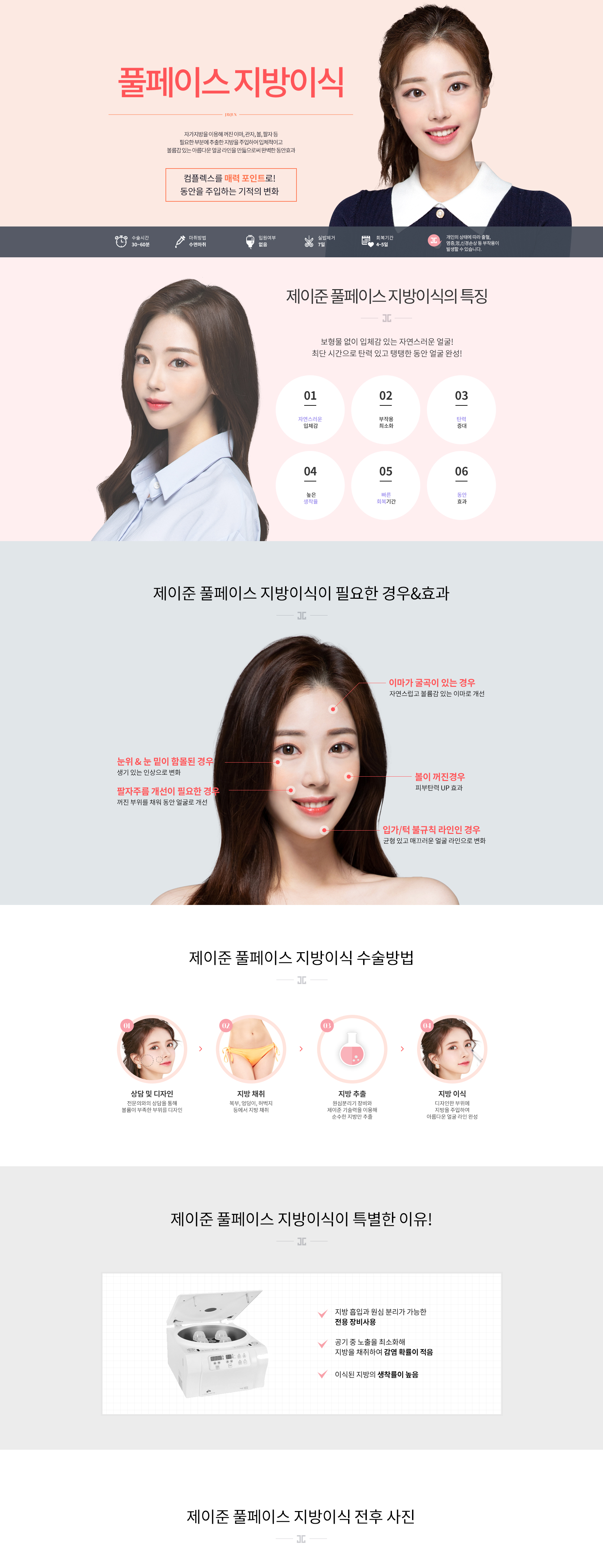 지방이식