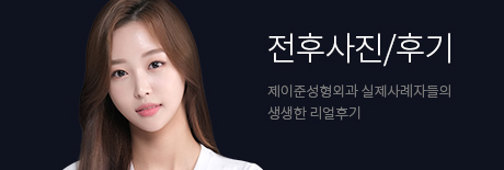 전후사진/후기